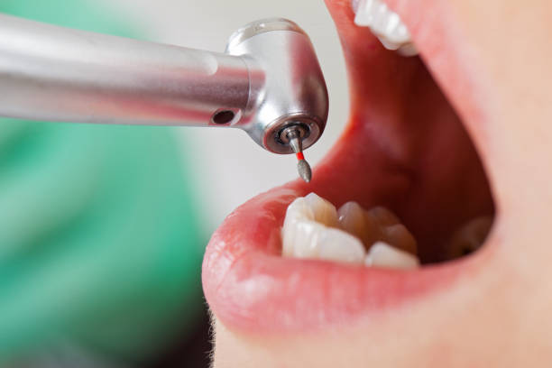 Best Mobile Emergency Dentist in Mazomanie, WI